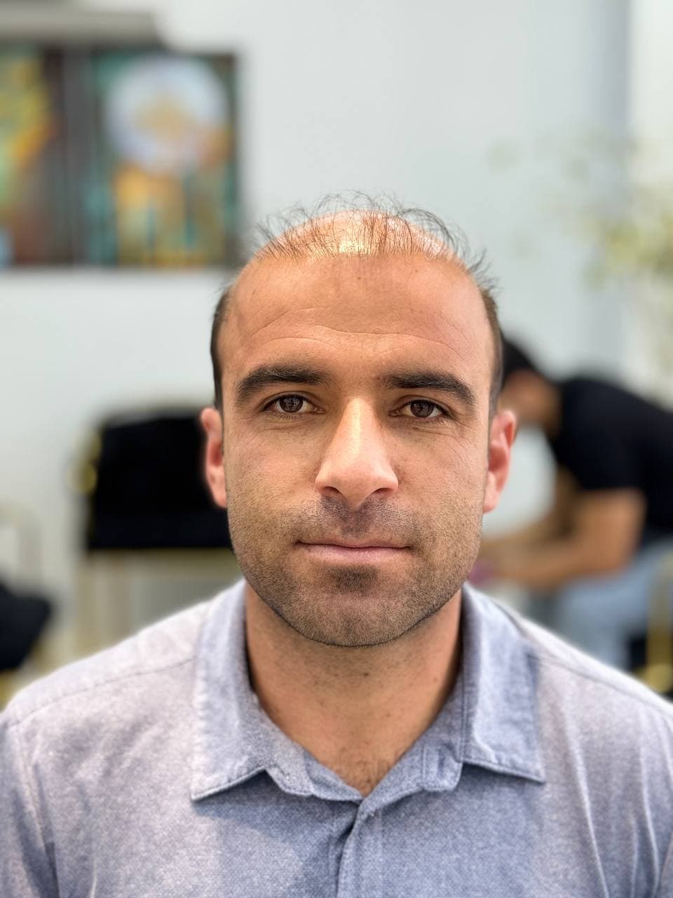 کلینیک ترمیم مو علی ثابتی
